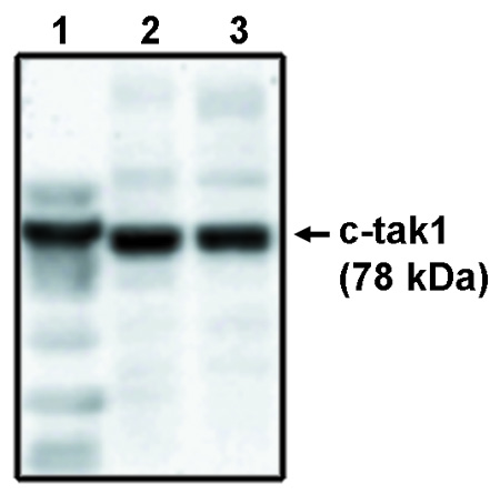 "Western blot analysis
using c-tak1 antibody
(Cat. No. X1088P) on
His-tagged c-tak1 (1),
RKO cell lysate (2) and
HCT116 cell lysate (3)."
